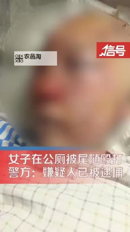 在公厕被殴打女子回应引发热议:事件真相全揭示图1