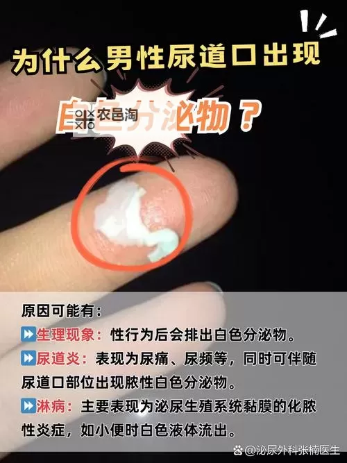 怎么弄出白色粘液的步骤与方法详解图1