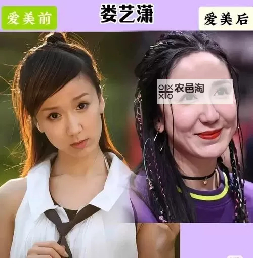 《整容天后百度影音:揭秘明星背后的美容奇迹与争议》图1