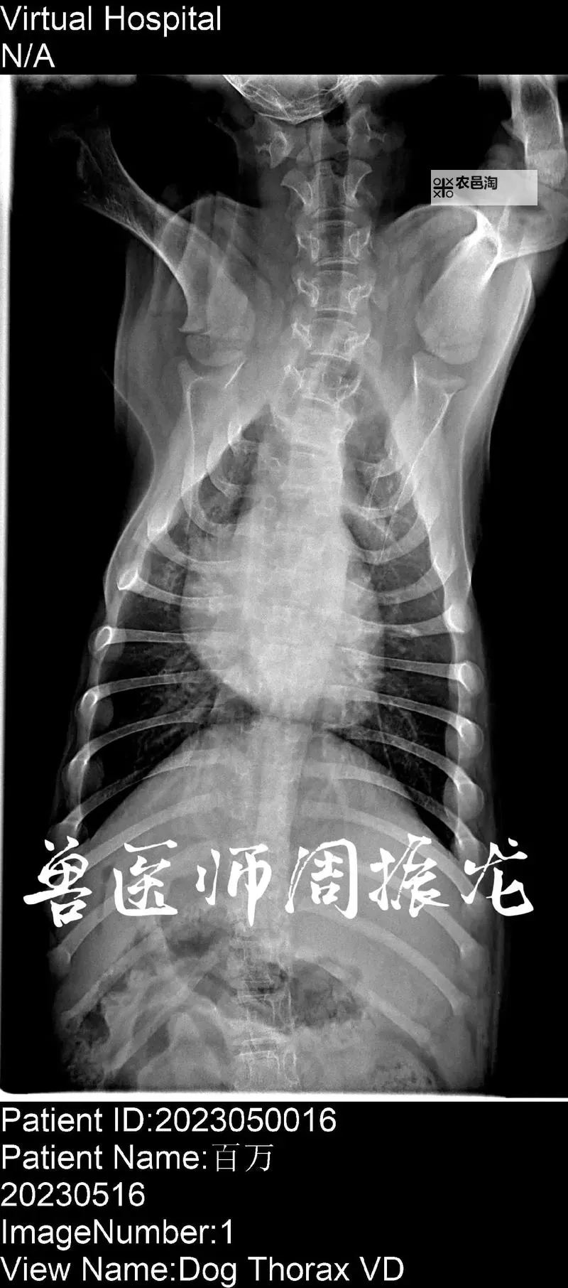 100%胸片曝光率可以免费不下载——轻松掌握曝光技巧的最佳途径图1