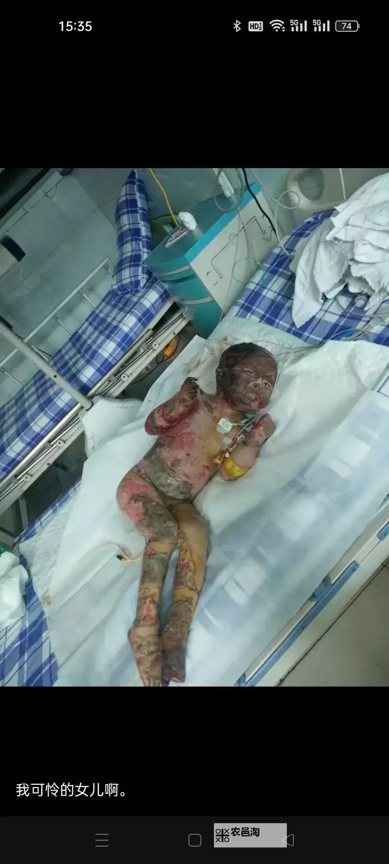 深夜反思：自杀二十天的心路历程图1